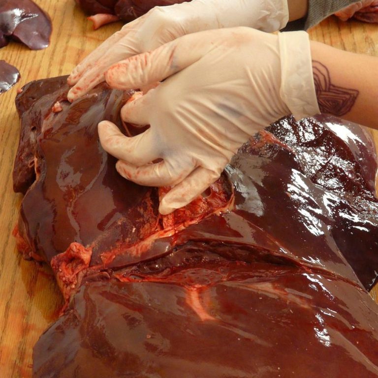 Healthy-liver-190a66dcff4947bcb7979ed189afde68